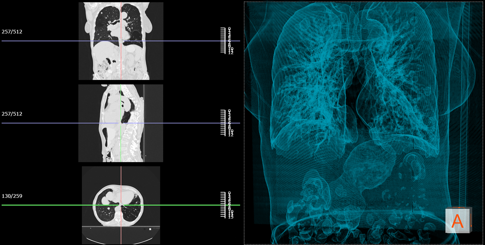 Web-Based Viewer for All Modalities